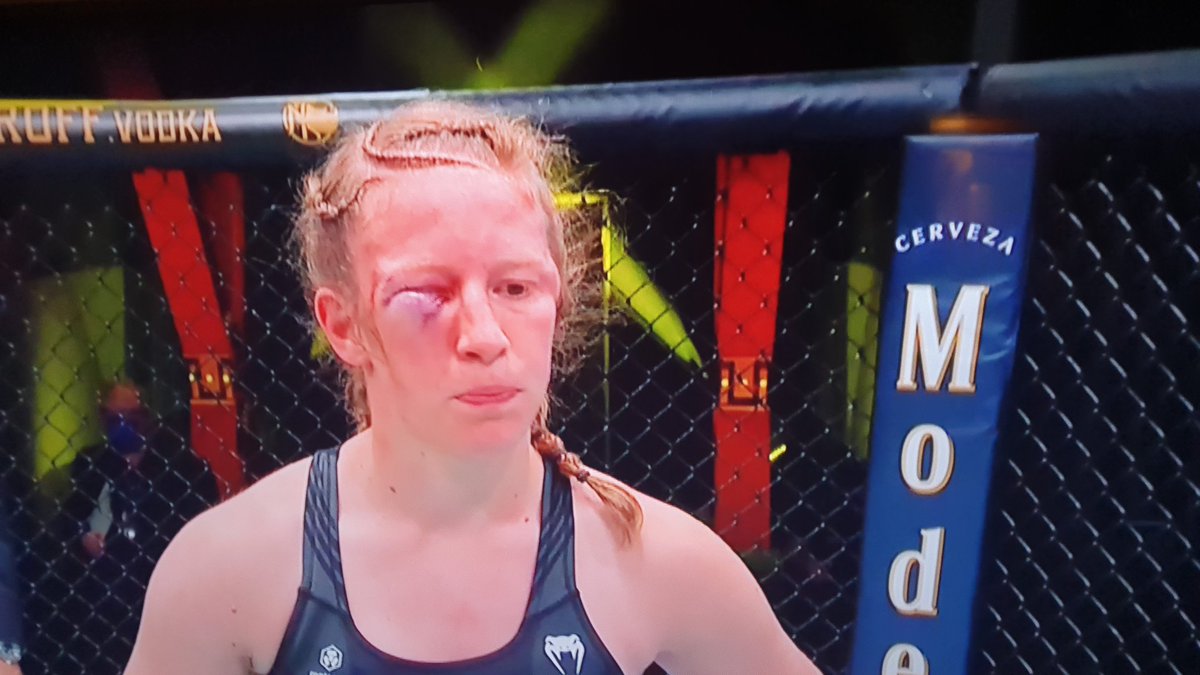 dancetomdance's tweet photo. Ouch! #UFCVegas32 https://t.co/RZA9pxJ0Ee