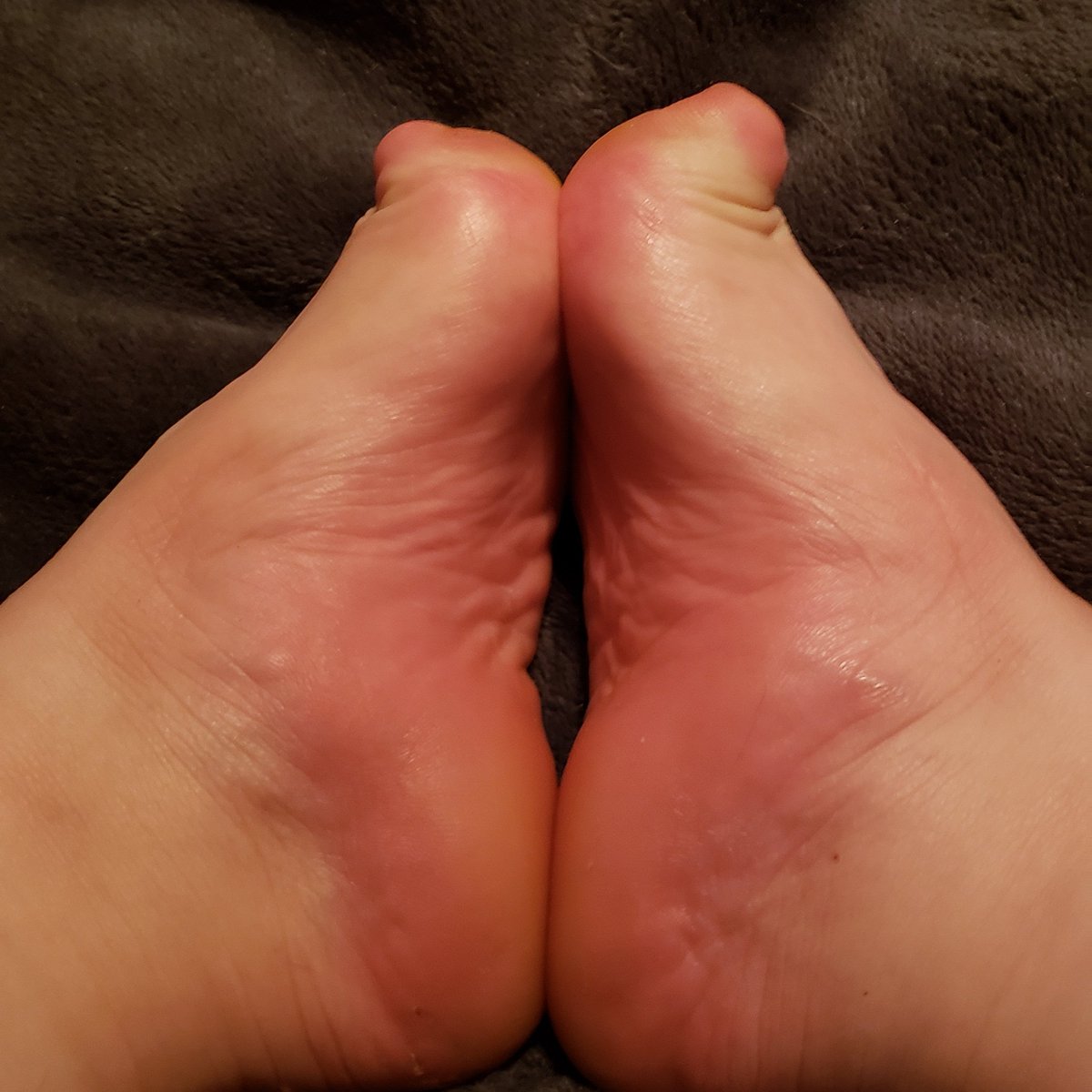 CJiorn's tweet photo. Find me on only fan!👣
 https://t.co/85YoHSFdwz

#onlyfans #findme #feetpicturesforsale #feetvideos #feet #footgal #footgirl #notoes #specialfeet https://t.co/8Ophxhcswr