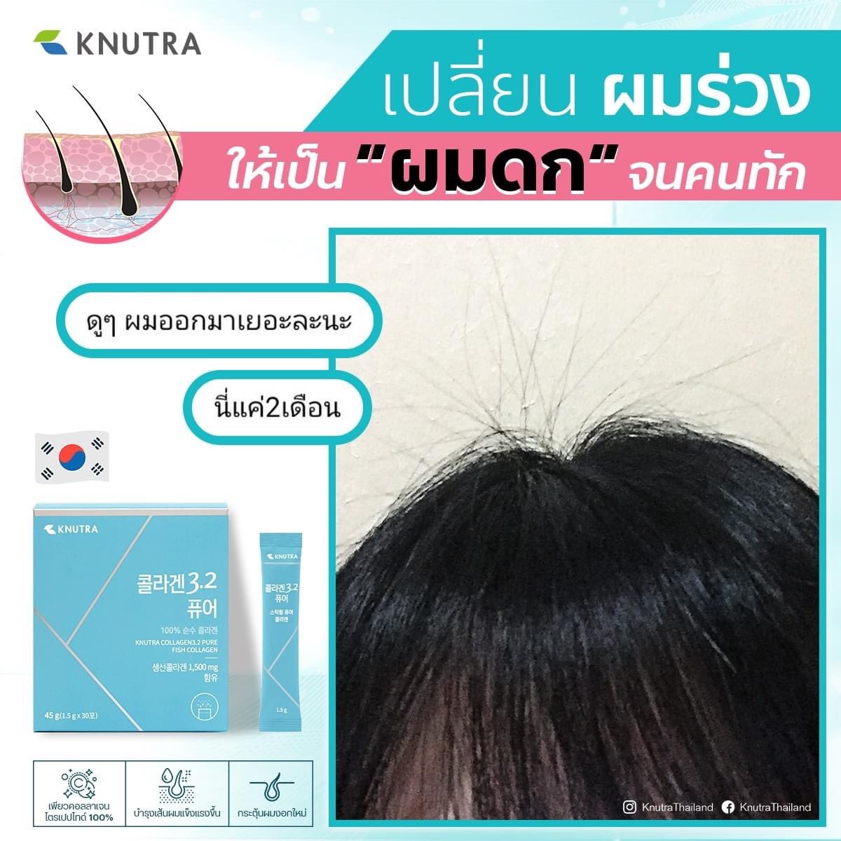 Knutrath's tweet photo. เปลี่ยนผมร่วง ให้เป็น “ผมดก” จนคนทักกันดีกว่า 👩🏻✨
#KNUTRA COLLAGEN 3.2 PURE เพียวคอลลาเจนไตรเปปไทด์
อีกหนึ่งตัวช่วยแก้ปัญหาคนผมร่วง ผมขาด ผมแห้ง ผมแตกปลาย จนเสียความมั่นใจ😭
#คอลลาเจนกล่องเขียว #คอลลาเจนเกาหลี #ไว้รีวิวห้ามขายของของโว้ยย https://t.co/iymCMdOh0o