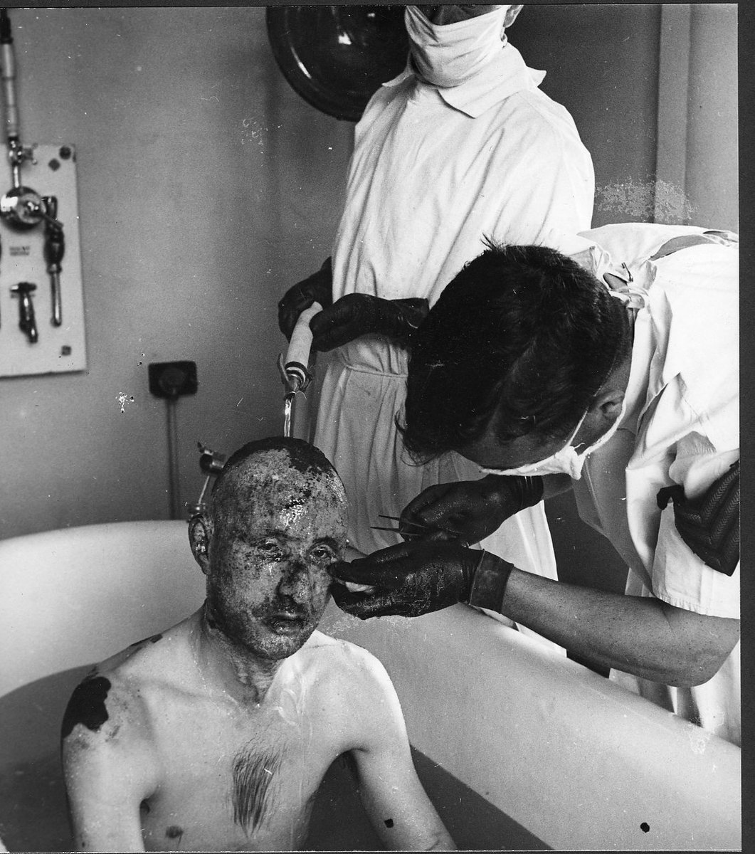 RAFBF's tweet photo. Today, many people still do not know of the bravery and sacrifice the members of the Guinea Pig Club made. Over the next few weeks, we will continue to share stories from the incredible members of the Guinea Pig Club.
Learn more ➡️ https://t.co/DMnBUb1a6P
#GPC80 #GuineaPigClub https://t.co/c2HkekigY8