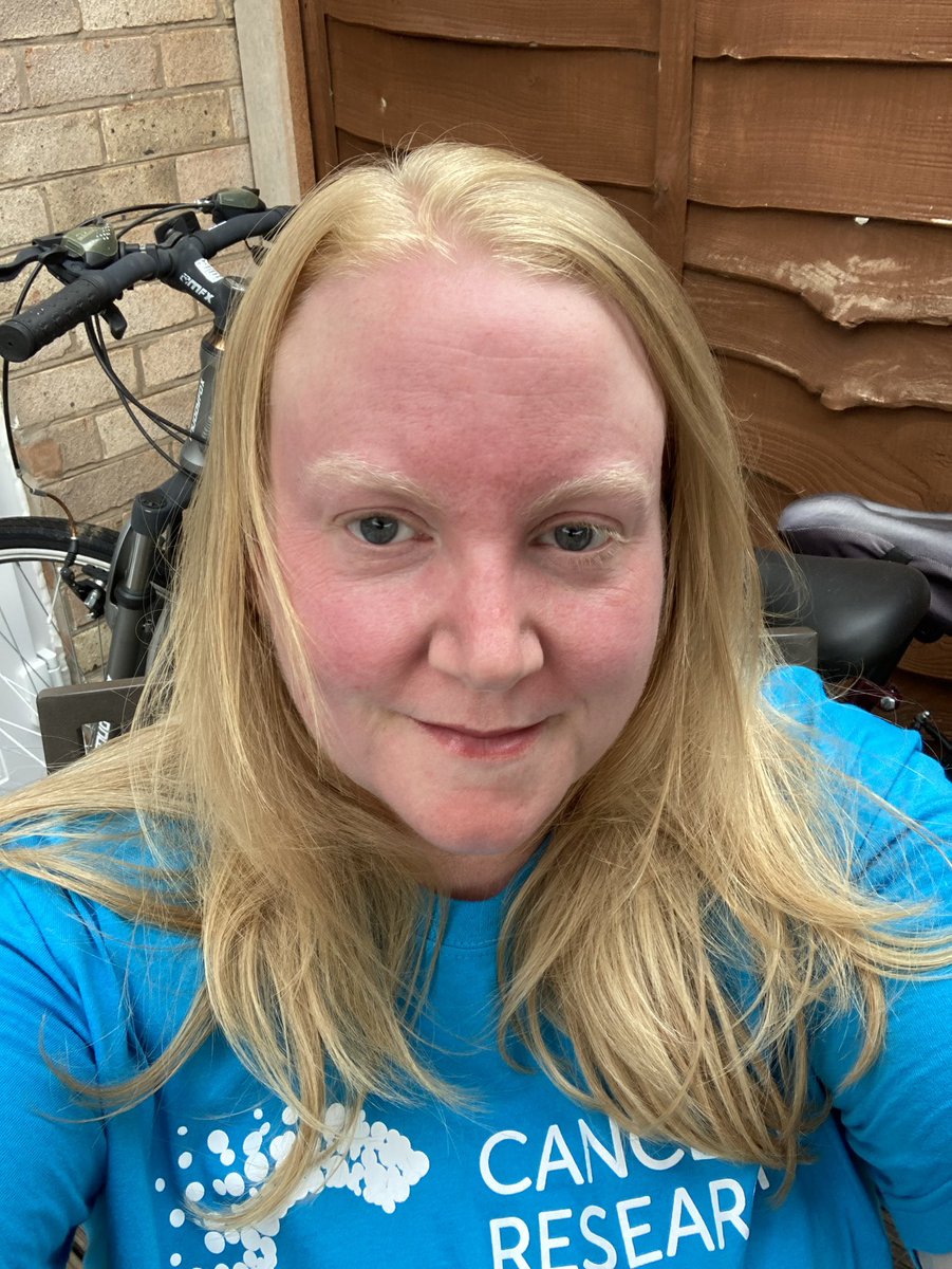 Chrissy79's tweet photo. #fitternotfatter Still slow, still canβt jog a mile none stop but still trying! Also still look like a tomato π
after π€·ββοΈπ₯΅π https://t.co/pGbxywxMeu