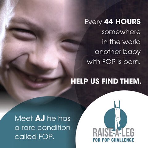 Meet AJ. He has a rare condition called FOP. Every 44 hours, somewhere in the world, another baby with FOP is born. Help us find them!
#fopchallenge #raisealegforfop #helpusfindthemissing #tinsoldiersfoppatientsearch #raredisease #CareAboutRARE