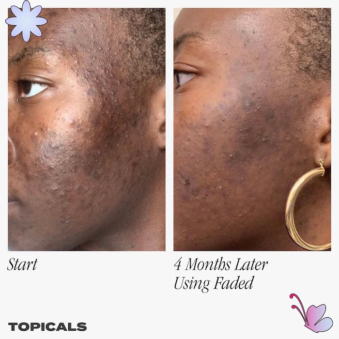 BalikSecrets's tweet photo. Dites Bye-bye à vos taches et cicatrices avec ce produit!!!

Faded De Topicals est un sérum semblable à un gel qui réduit l'apparence des marques tenaces, des cicatrices et des taches. 
Disponible sur notre site https://t.co/F1YEARGxZE au prix de 26.000frs https://t.co/PRGKxWCJuC
