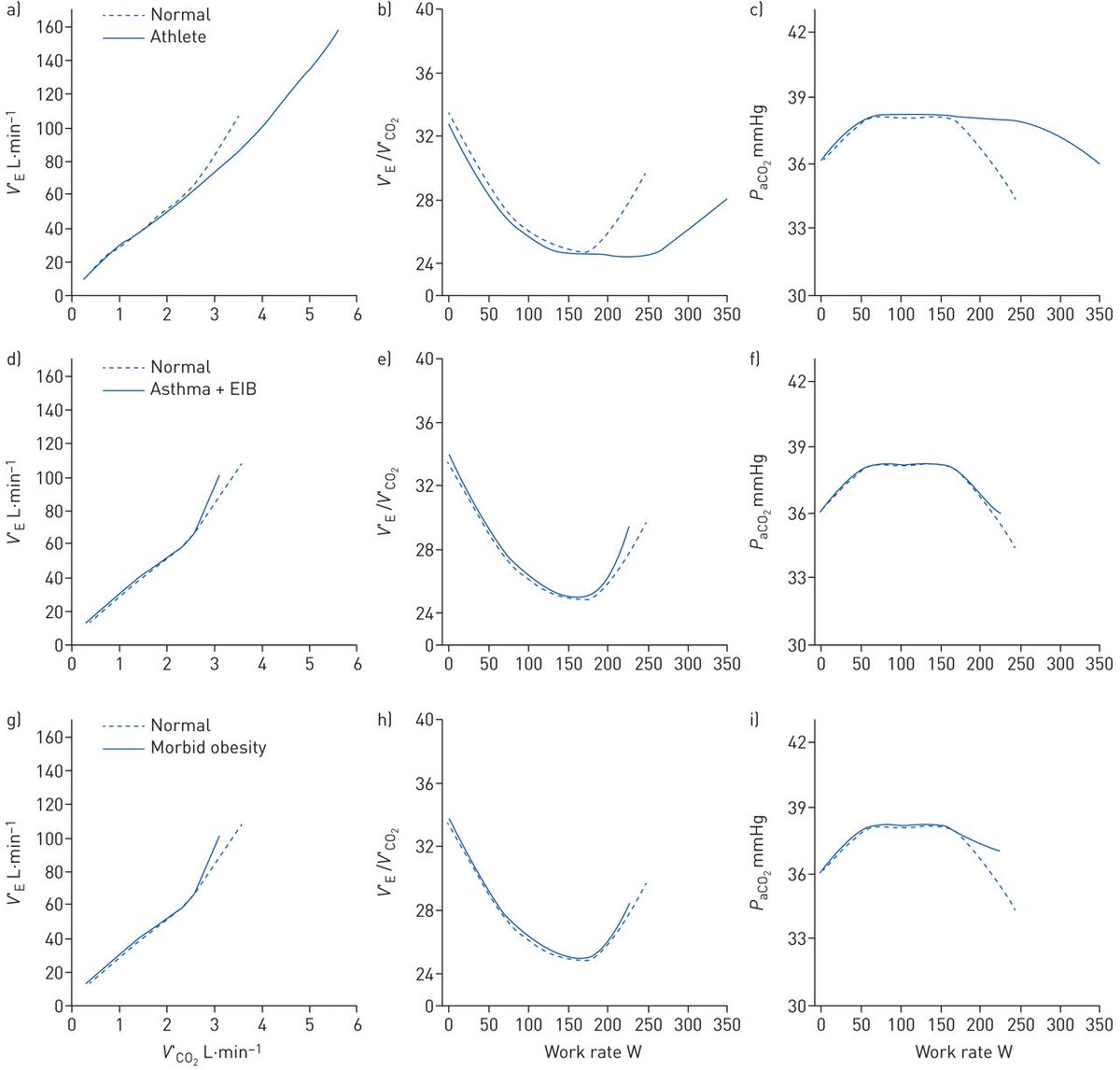 The minute ventilation/CO2 production ratio is useful when evaluating exercise responses. This review describes the physiology of the minute ventilation/CO2 production ratio and the ratio response in endurance athletes, asthma and obesity. bit.ly/3mFdr81