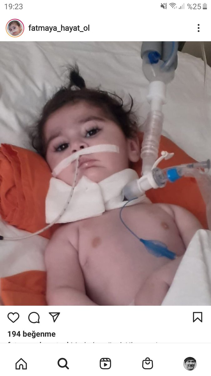 Ebru22998769's tweet photo. @haluklevent @FatmayaHayatOl Bu bebeğin çıkaramadığı sesi olalım takipçisi çok az süremiz azaldı instagramdan ve twitter da takip edebilirmisiniz süre azalıyor lütfen sesimizi duyuramıyoruz ne olur hiç bir şey yapamıyorsanız sayfamızı paylaşın lütfen Retweet yapmayı unutmayalım https://t.co/A6wMcjhxJS