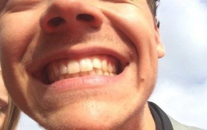 fairysunshineee's tweet photo. harry styles details https://t.co/fwiO6DKKN3