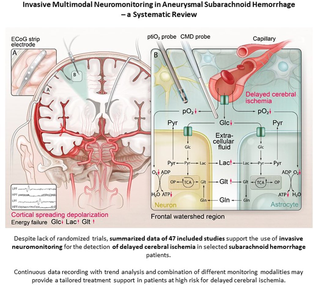 Invasive Multimodal Neuromonitoring in Aneurysmal Subarachnoid Hemorrhage: A Systematic Review ahajournals.org/doi/10.1161/ST…