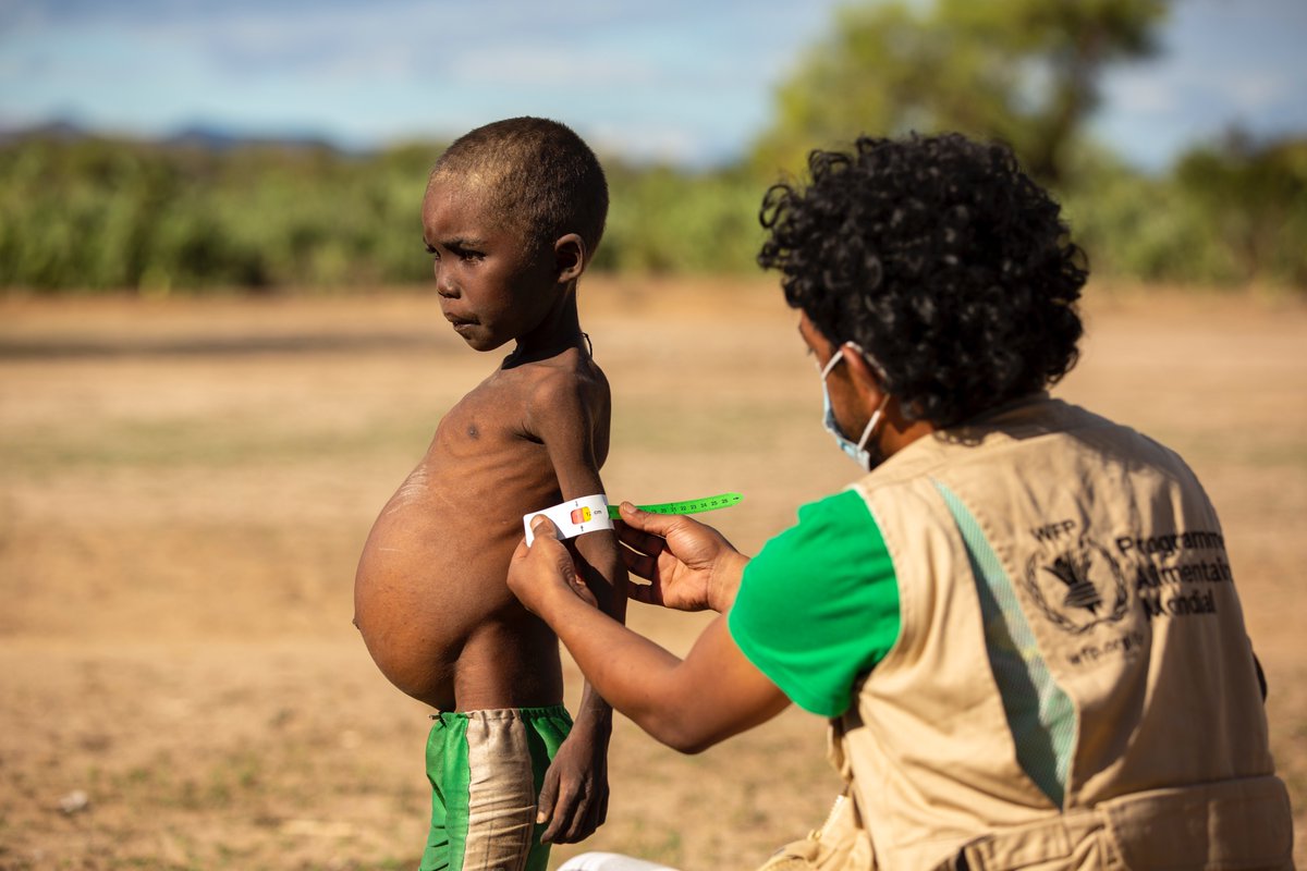 #Malnutrition among #Children 👦👧expected to quadruple 📈in Southern #Madagascar 🇲🇬 because of the #drought led by #ClimateCrisis 👉 wfp.org/news/malnutrit…