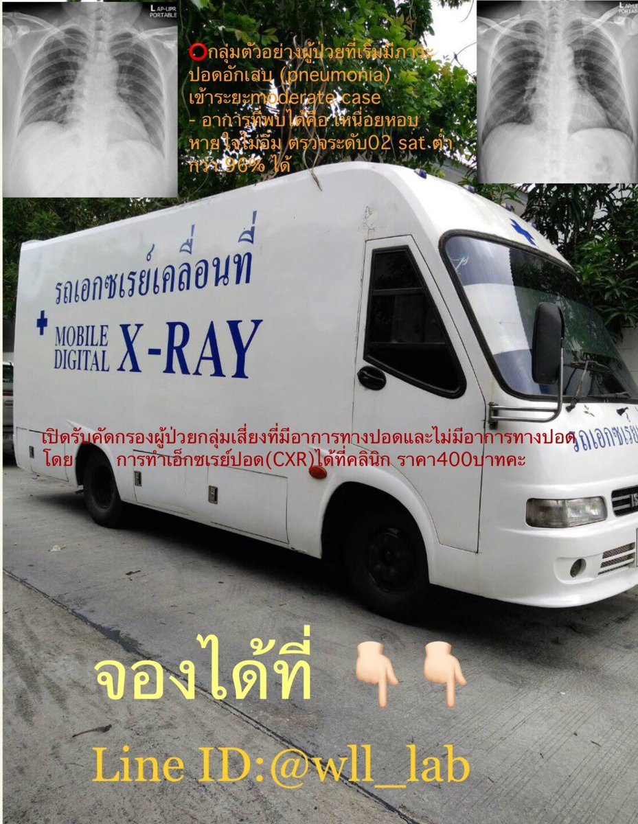 baiitoeeyy2's tweet photo. บอกบุญสำหรับคนที่ติดโควิดแล้วต้องรักษาตัวที่บ้าน สามารถโทรไปจองคิวเอกซเรย์ปอดกับ เวิลด์ลิ้งค์แล็บ ได้เลยตาม Line ID : wll_lab เป็นแล็บที่เตยกับที่บ้านตรวจหาเชื้อโควิด ใครสนใจทักไปจองเลยนะคะ  ราคา 400 บาทเอง ถูกมากๆ เจ้าหน้าที่ดูแลดีมาก https://t.co/UiyfPDgP2O