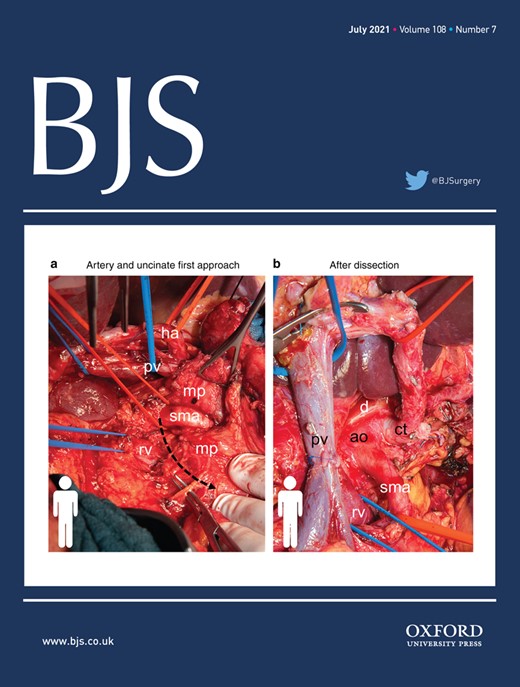In July's BJS: Organ preservation in rectal cancer: towards the norm rather than the exception academic.oup.com/bjs/article/10… <a href="/AmyLightnerMD/">Amy Lee Lightner, MD</a> <a href="/bplwijn/">Bas Wijnhoven</a> <a href="/des_winter/">Des Winter</a> <a href="/ksoreide/">Kjetil Søreide</a> <a href="/MalinASund/">Malin Sund</a> <a href="/evanscolorectal/">Martyn Evans</a> <a href="/nfmkok/">Niels Kok</a> <a href="/robhinchliffe1/">Robert Hinchliffe</a> <a href="/young_bjs/">Young BJS</a>