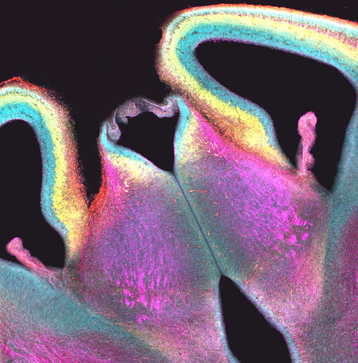 #SciencePhoto_IN
"Surprised teddy bear"
Author: Ana Moreno <a href="/anillu_1997/">Ana</a> 
Lab: Dr. Salvador Martínez <a href="/SalvaMP1961/">Salvador Martinez</a> Dr. Diego Echevarría <a href="/DEchevarria_Aza/">Diego Echevarria</a> Dr. Eduardo de Puelles <a href="/edepuelles/">Eduardo de Puelles</a> 
"Coronal slice of E15.5 mouse brain. Immunofluorescence against NFEM (magenta), ...1/2