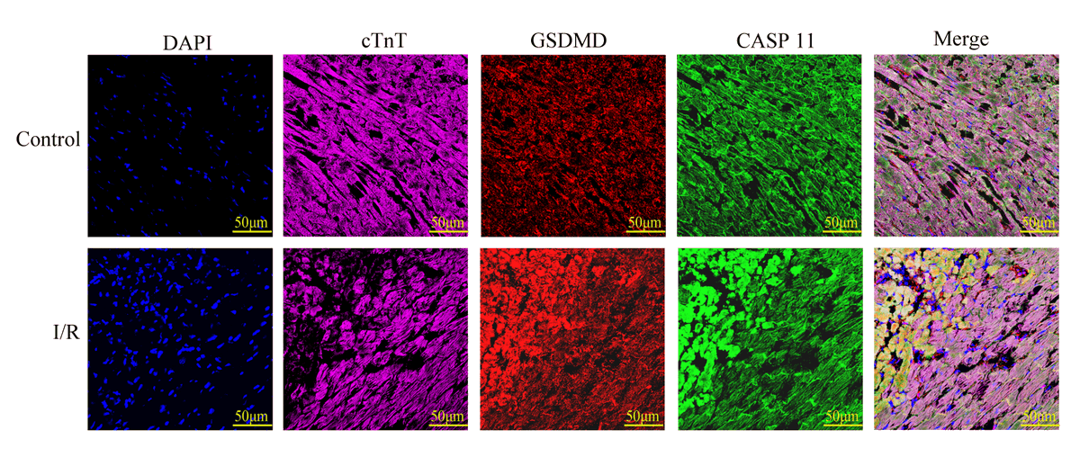 Shi & colleagues found #OxidativeStress activated #caspase-11 & #GSDMD in #cardiomyocytes, caused #pyroptosis as well as aggravated myocardial #IschemiaReperfusion injury. Learn more at ow.ly/WsAD30rODwx 

@FudanUniv