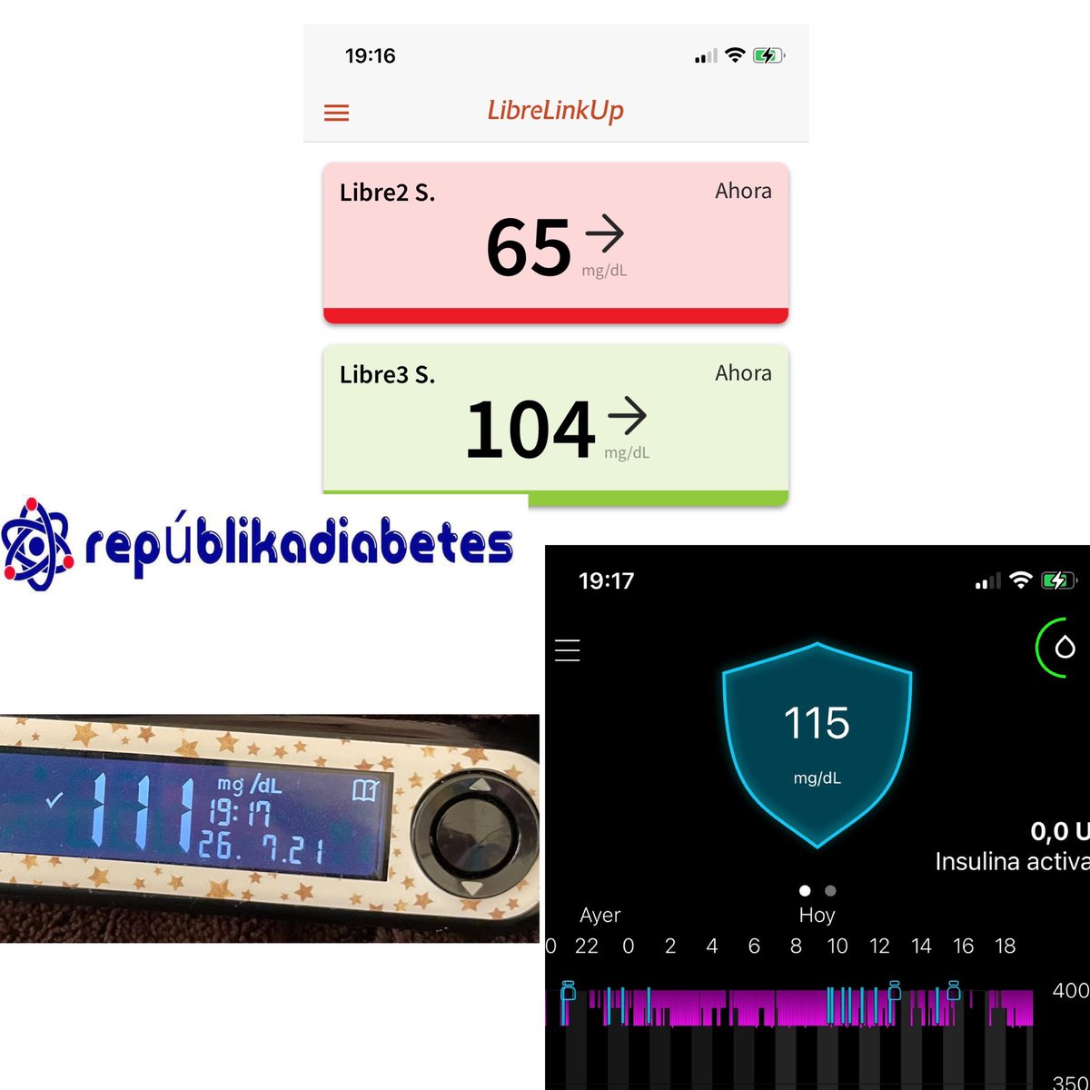 El partido sigue con una ida de olla del libre2 el libre3 resiste y guardian3 ganando por goleada !!#FreeStyleLibre #medtronicdiabetes #diabetESP #cgmparatodos