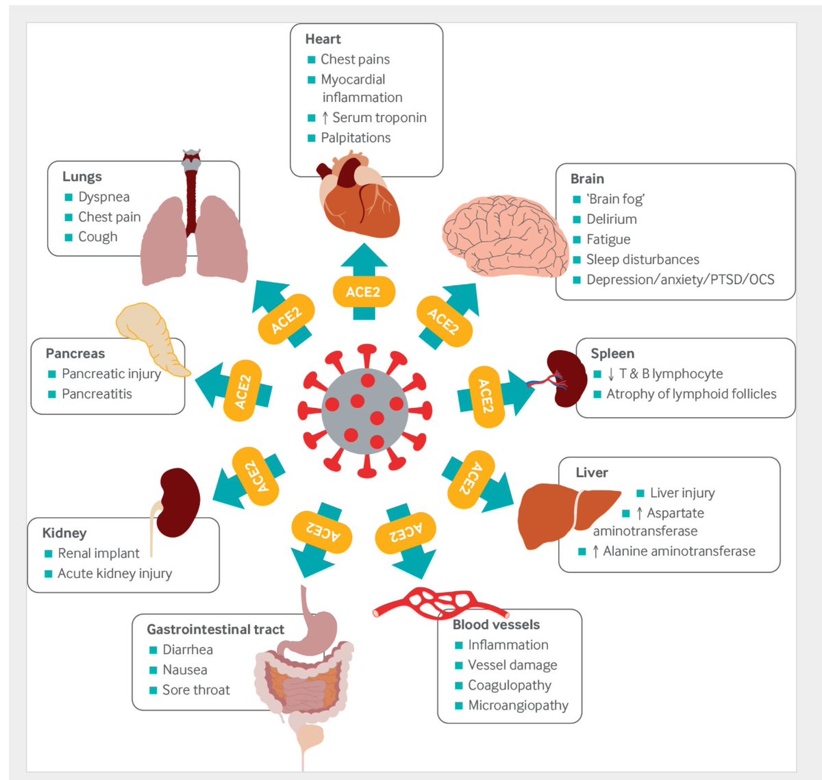 chrischirp's tweet photo. Great review in @bmj_latest of what we know - and all that we don't - about Long Covid. 

Including this graphic of different ways it can manifest. 

article here https://t.co/zsqNVNVEo8 https://t.co/5XU1W557wQ