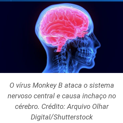 BlogDoTato67's tweet photo. #Saude 
O vírus #MonkeyB (herpes tipo B), dificilmente atinge humanos, mas quando ocorre os casos quase sempre são fatais.
▶Em torno de 80% dos pacientes não tratados morrem por complicações do vírus, que ataca o sistema nervoso central, causando um severo inchaço no cérebro. https://t.co/CeHuDsyNT2
