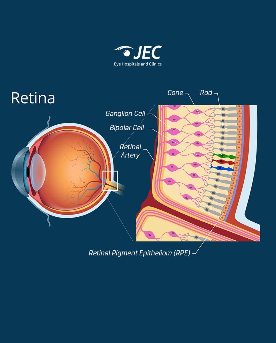 JECEyeHospital's tweet photo. Retina merupakan bagian penting mata yang berperan besar terhadap kemampuan manusia dalam melihat. Oleh karena itu, ketika retina mengalami kerusakan, kemampuan untuk melihat juga akan mengalami gangguan dan berpotensi terjadi kebutaan permanen!
#JEC #Retina #JECKnowledge https://t.co/paOO3Fr3V3