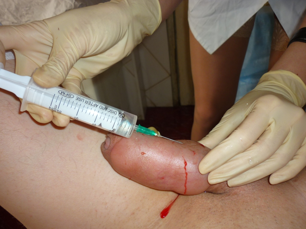 any business should be carried out enthusiastically!
#medfetish #surgeryfetish #injection #anestesia #infnlation #perfectpenis