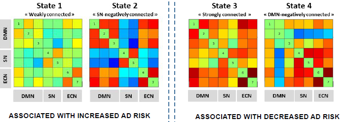 So_Dautricourt's tweet photo. Interested in dynamic functional connectivity patterns associated with #Alzheimers risk and protective factors ? Check out our poster at #AAIC2021 with @julie_gonn @RobindeFlores @ChetelatLab and @vdcalhoun 
➡️poster 51782 - Virtual Hall 3
#dFNC #fMRI #connectivity https://t.co/5PUJf8IQh9