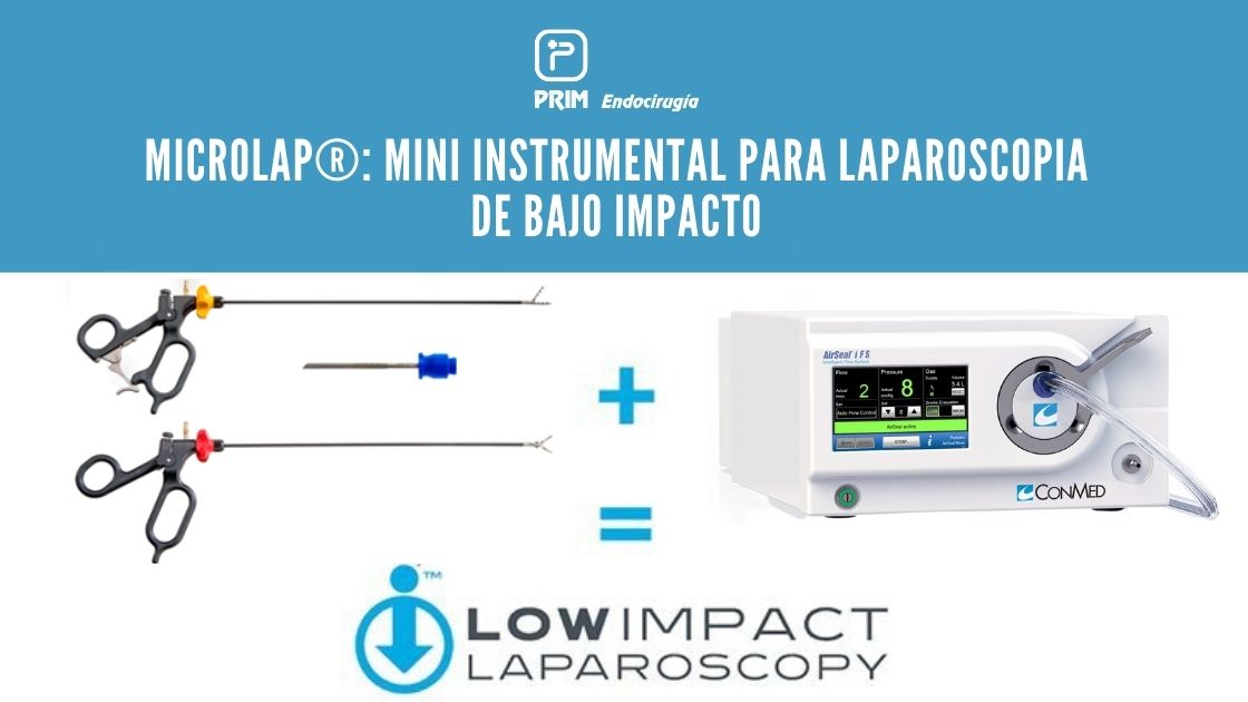 primendocirugia's tweet photo. #MicroLap® es la gama de instrumental de mini #laparoscopia aliada ideal del sistema de insuflación inteligente #AirSeal® iFS para realizar #LaparoscopiaDeBajoImpacto

💻Y hoy os lo contamos todo sobre estos instrumentos en el blog ⬇️

https://t.co/uF3OMGpp0X 

#SoMe4Surgery https://t.co/9to3pLtLJt