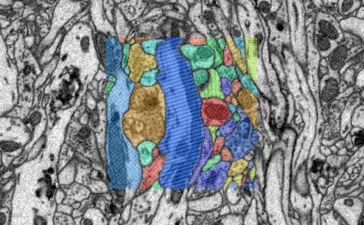Do you need ground truth for your deep learning project? Check out our manual annotation service. Get high-quality annotations from our trained annotators for your image data. Learn more: webknossos.org/services/annot…
