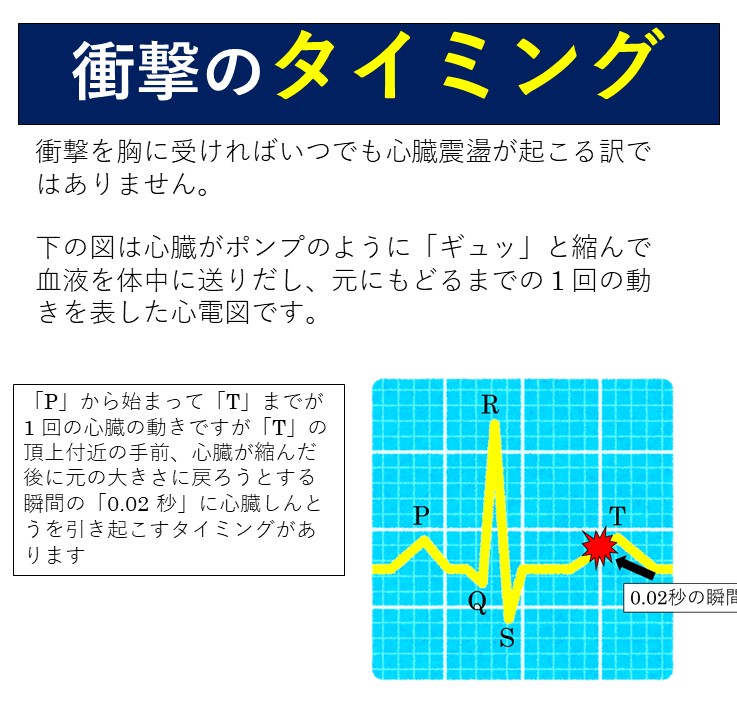 野球などボールスポーツや格闘技での危険な事故で起きる心臓震盪 しんぞうしんとうについて Togetter