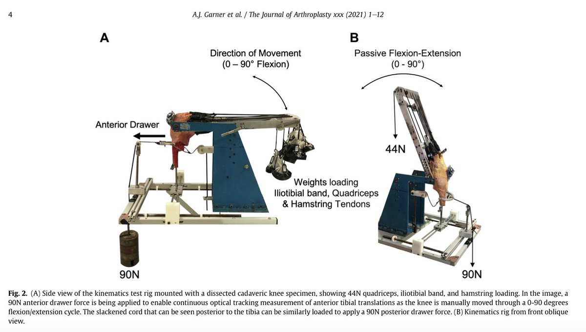 DrAmyGarner's tweet photo. So pleased with the way our latest paper has turned out: increased anterior-posterior stability with partial and compartmental arthroplasty compared to #TotalKneeReplacement. 

https://t.co/pAa9w8gusC

@RCSnews @MSkLab1 @ICBiomechanics @DunhillMedical @orthorobodoc @OliDandridge https://t.co/pY1pSLiEi7