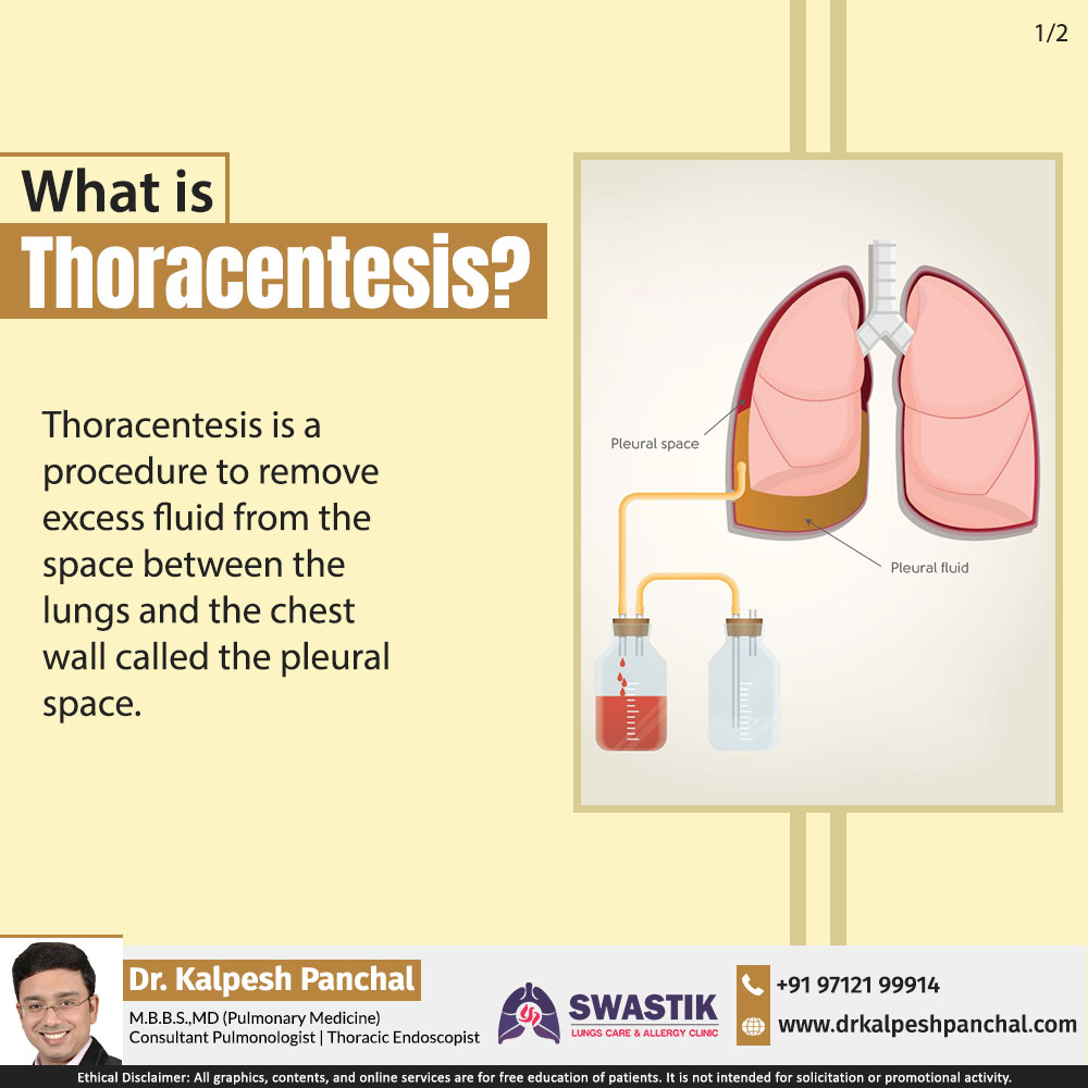 drkalpeshpulmo's tweet image. What is #thoracentesis?
.
.
#healthcare #respiratorytherapy #SwastikClinic #lungdisease