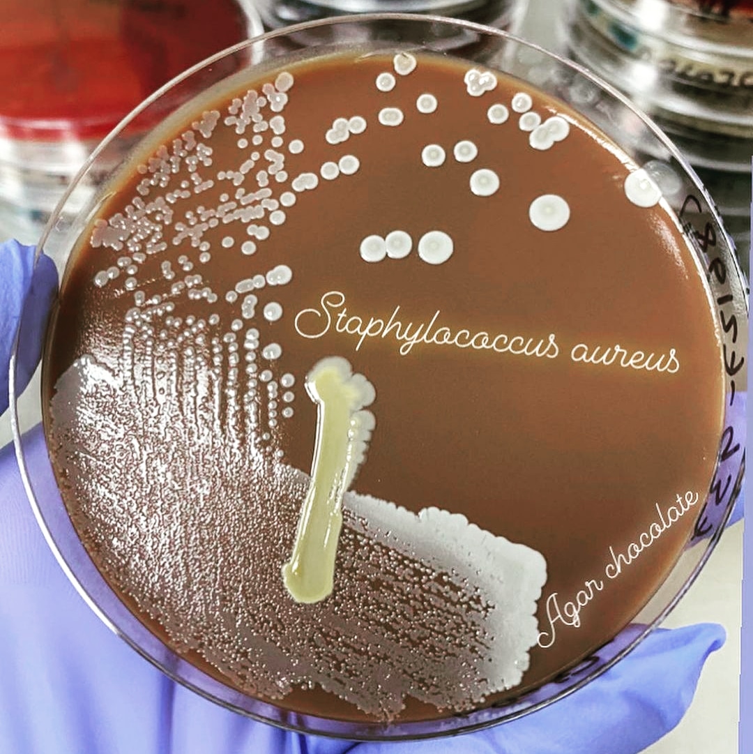 mICROBIO on Twitter "🦠Staphylococcus aureus 🧫Agar Chocolate https//t.co/cVh4aISpld" / Twitter