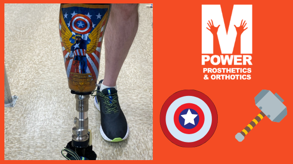 MPowerPO's tweet photo. #FindYourIndependence A recent patient did just that by having our lab create a custom socket with a #CaptainAmerica theme. #Marvel #AvengersAssemble @ChrisEvans #Prosthetics #Proteor #ProteorUSA #RushFoot https://t.co/VxZZKlByrV