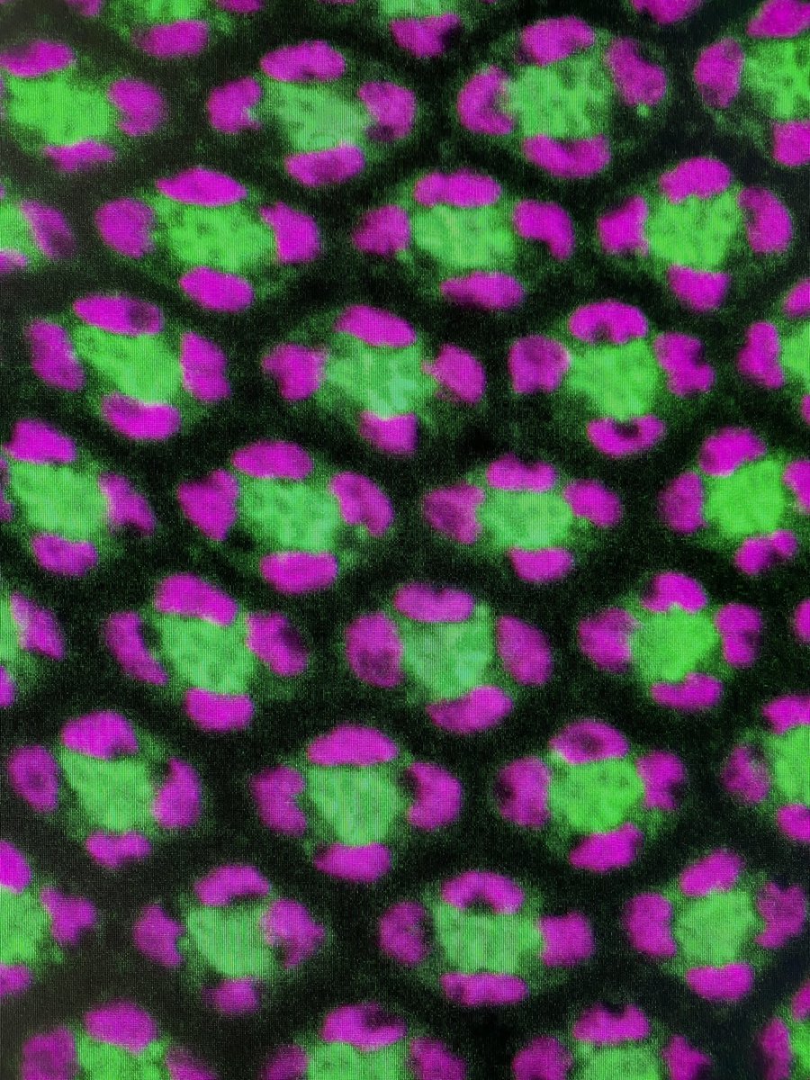 pHlyLab_SJSU's tweet photo. Still got it:) On the confocal after too many months away! #PIatthebench #prettyeyeforawhitefly https://t.co/XipJWxz2jH