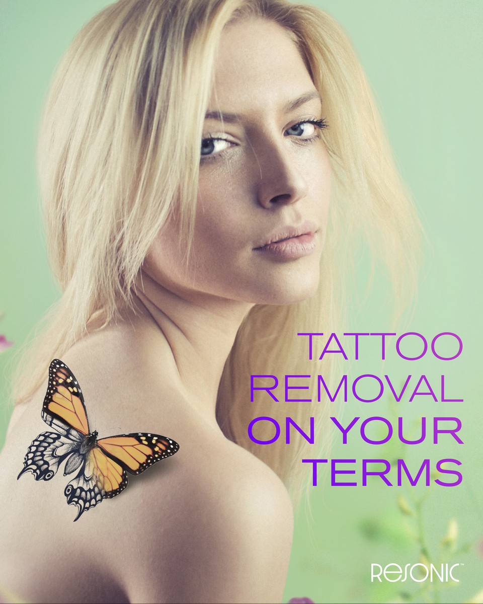 I Scheduled a Resonic Apponitment  rTattooRemoval