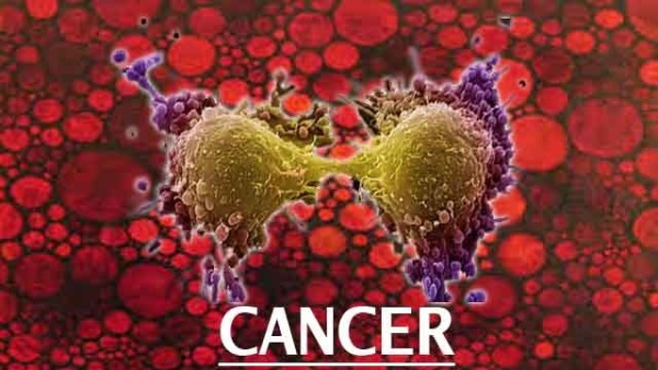 lisahal98258897's tweet photo. #Cancer often has the ability to spread throughout your body. Cancer is the second-leading cause of death in the world. But survival rates are improving for many types of cancer, thanks to improvements in cancer screening, treatment and prevention. #WEBINAR https://t.co/4SbZ6Asr7z