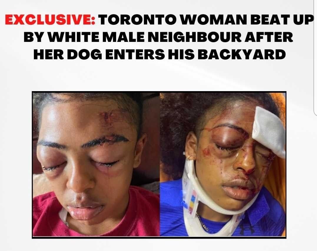 This took place in good ol' Toronto. When we state we experience violence, some people simply play it off saying we are paranoid, overreacting, overly sensitive, etc..  Let's not forget that over 60K Black females are missing in the USA. This is the reason why we advocate.