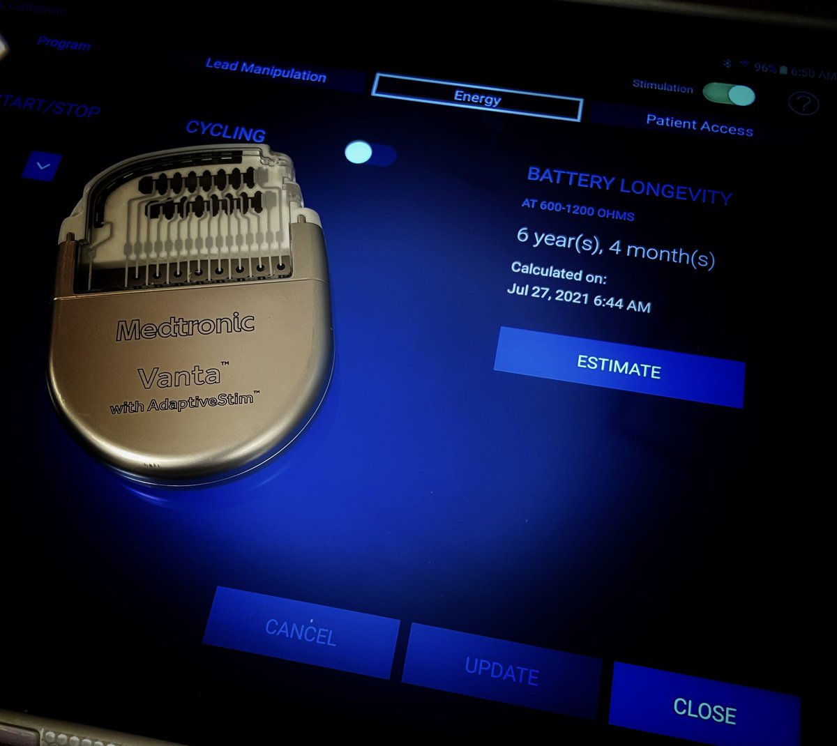 Today we implanted the worlds first ever <a href="/Medtronic/">Medtronic</a> Vanta™️ recharge-free neurostimulator right here in Toledo, Ohio. This device offers unmatched MRI access and personalized programming with real time battery longevity. #vanta #neuromodulation #painfreemd