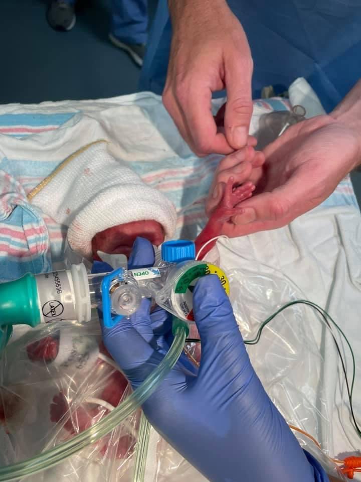 Dson1305's tweet image. I saw God today. 

Olivia Grace Deason 
1 pound and 1 ounce
7/27/21

And she’s the most beautiful thing we’ve ever laid our eyes on. To God Be The Glory. I can’t explain how much all the people who have prayed mean to us. It’s going to be a long road, but I’m pumped for the ride.