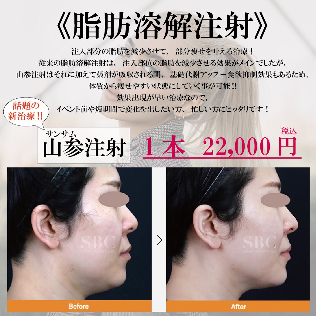ট ইট র 湘南美容クリニック 福島院 新治療のお知らせです 山参 サンサム 注射 山参や生薬エキス複合体が配合されている脂肪溶解注射です 更に食欲抑制効果もあるんです 湘南美容クリニック福島院 山参注射 ダイエット ট ইট র 湘南美容クリニック 福島院 新治療のお知らせです 山参 サンサム 注射 山参や生薬エキス複合体が配合されている脂肪溶解注射です 更に食欲抑制効果もあるんです 湘南美容クリニック福島院 山参注射 ダイエット