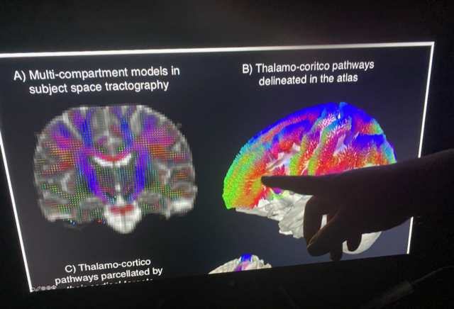 DrBodySenses's tweet photo. Hi👋🏾I'm Stefanie. I use advanced multimodal MRI methods &amp; behavioral assessments of sensory &amp; motor functions to study how children develop play &amp; motor skills🧠This informs interventions to support those who need them.  #BlackInNeuroRollCall @BlackInNeuro #BlackInNeuroWeek2021 https://t.co/855WRTl1ST