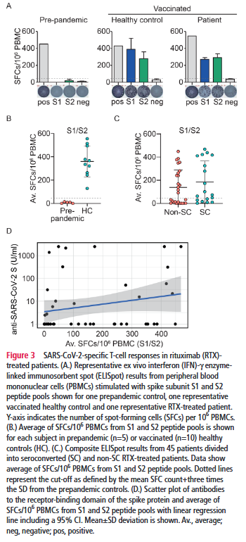 eular_ARD's tweet photo. Check out the latest findings on #COVID19 vaccination &amp; rituximab:

▶️vaccinacion induce antibodies in RTX-treated patients once peripheral B cells at least partially repopulate
▶️specific T cells were detected, independent of humoral immune response

https://t.co/lxjbdTWgaV https://t.co/ROATuFMtB2