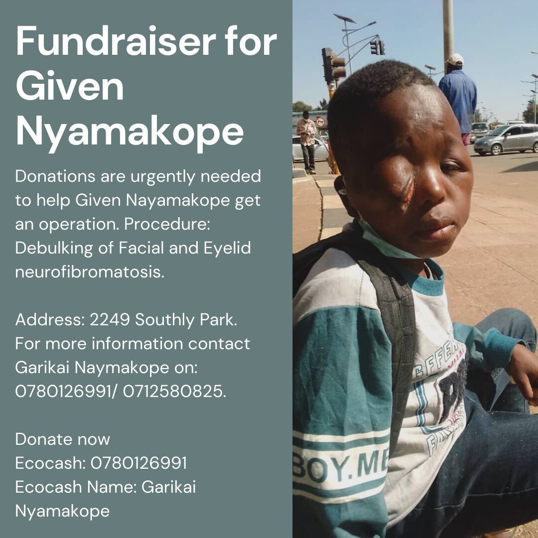 mandisa_trust's tweet image. Given Nayamakope needs your help. Procedure: Debulking of Facial and Eyelid neurofibromatosis. Your contributions will go a long way. More information has been attached.

Disclaimer: Please note that Mandisa Foundation Trust has been given consent to publish this plea for help...
