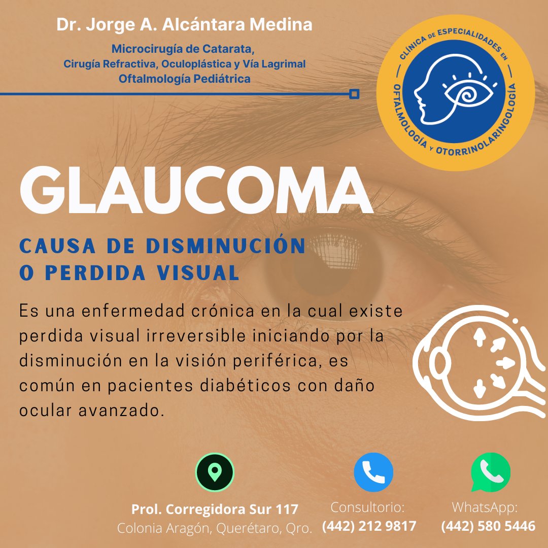 Whatsapp: (442) 580 5446 Consultorio: (442) 212 9817 #OftalmologoAlcantara #OftalmologoMedina #Oftalmo #OftalmologoenCorregidora #OftalmologoenQueretaro #Otorrino #Otorrinolaringologia #OftalmologiaPediatricaQueretaro #CirugiaRefractivaQueretaro #CirugiadeCatarataQueretaro