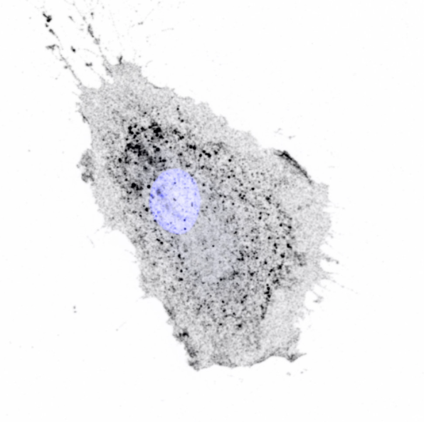 A protein involved in making cells move offers a clue to how certain types of #cancer metastasize and develop into secondary tumours, according to new research from WMS bit.ly/3iTOgxD