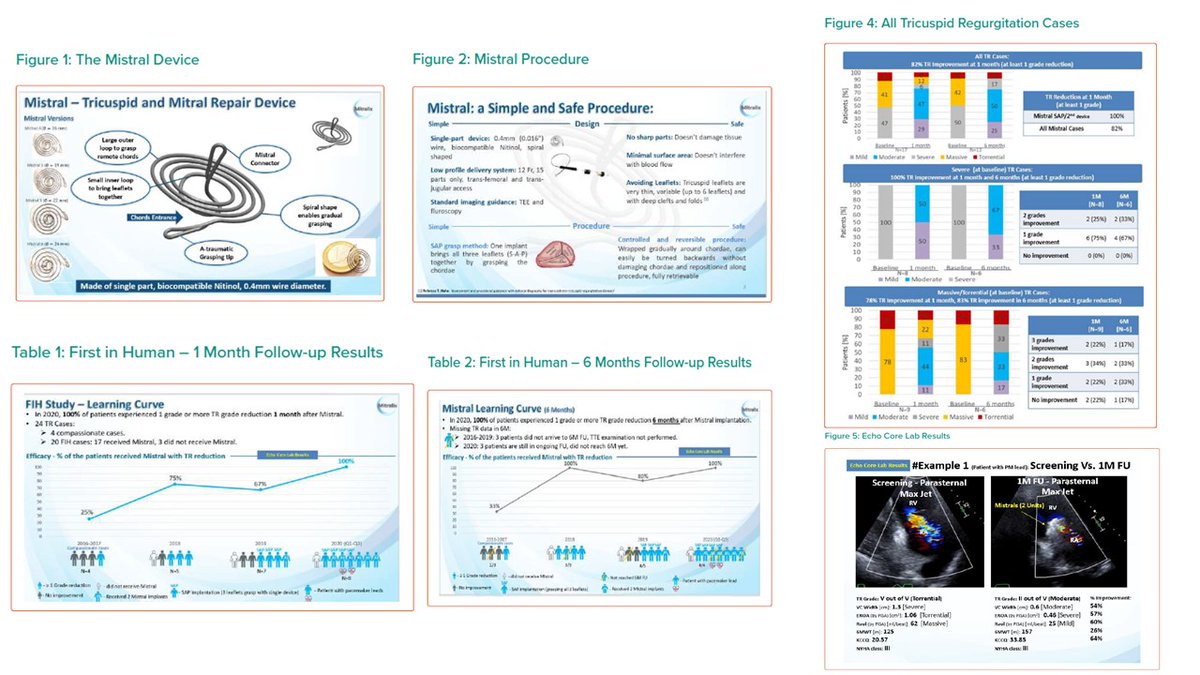 Mistral Tricuspid Regurgitation Echocardiography CoreLab Analysis Results, as presented in #JIM2021 ePoster:
icrjournal.com/articles/mistr…