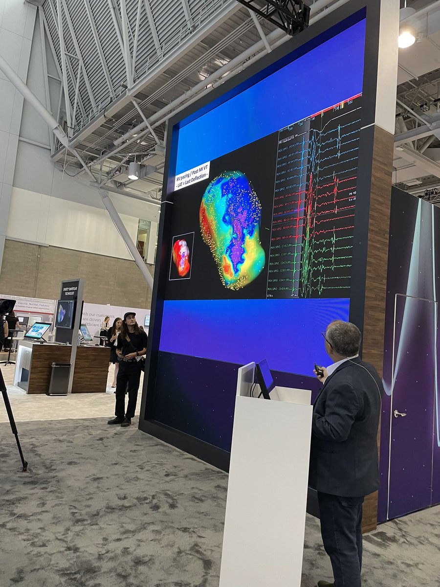 Sachin Vadodaria (@sachinjv) on Twitter photo #HRS2021 live talk on #HDGrid by Dr Andre d’Avila <a href="/AbbottCardio/">Abbott Cardiovascular</a> booth #proudtobeabbott #HRS2021 live talk on #HDGrid by Dr Andre d’Avila <a href="/AbbottCardio/">Abbott Cardiovascular</a> booth #proudtobeabbott