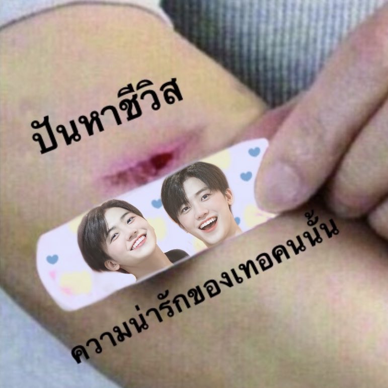 ผม :