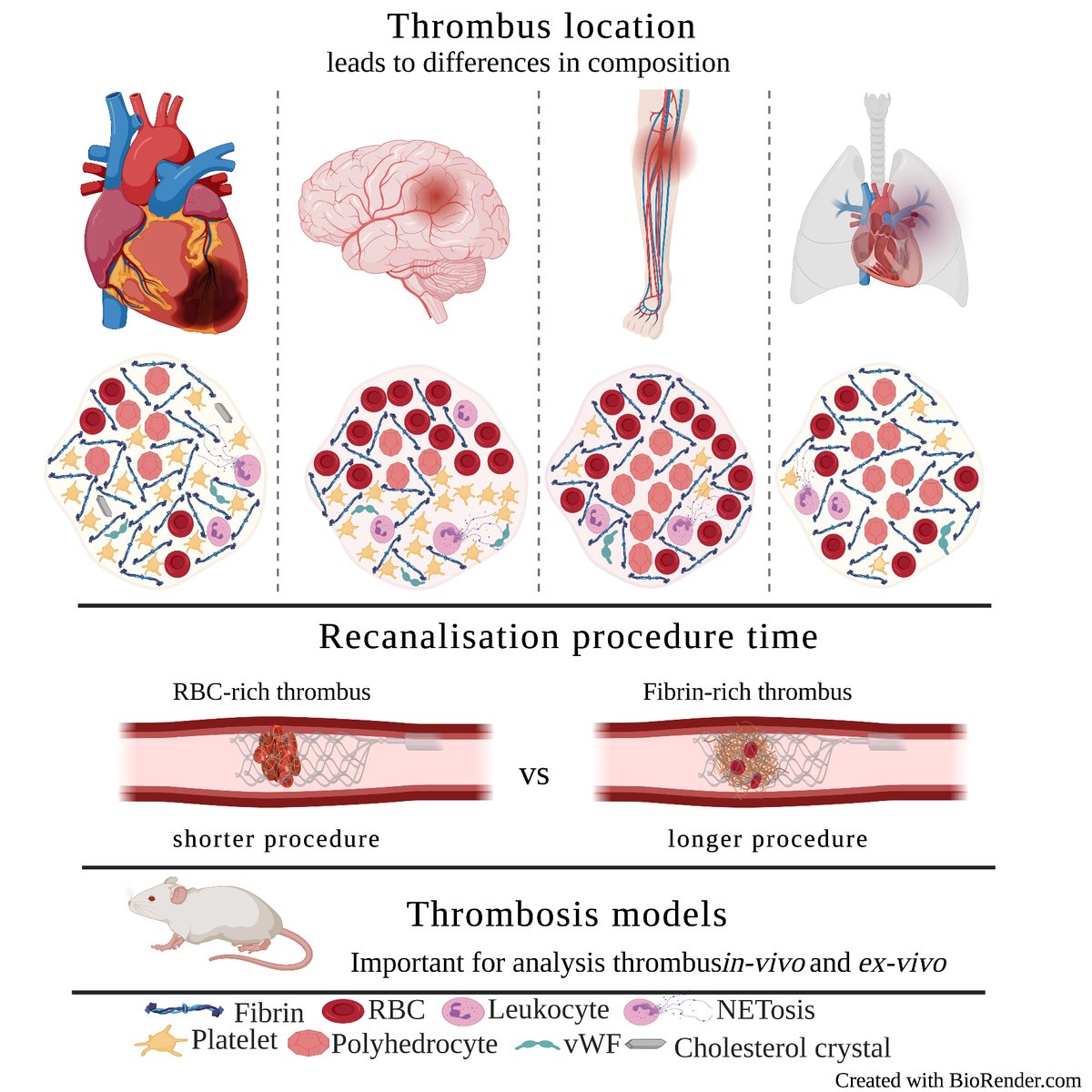 Want to know more about compositions of clots from patients with different thrombotic disorders and how this relates to disease? Must read ATVB review by Alkarithi et al.
@FraserLMacrae 

ow.ly/kFMn50FF42s