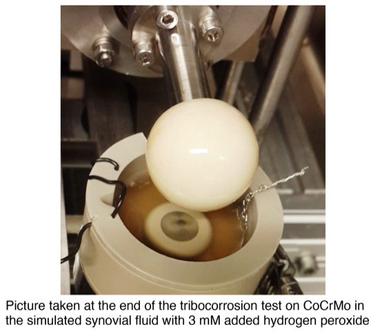 Basic Science Tips (in Memory of Fred Nelson, MD) (@orthoscienctips) on Twitter photo Don't miss my latest #BasicScienceTip:
"Nickel-Free High-Nitrogen Austenitic Steel: A New Metal on the Block" See how <a href="/ORSsociety/">Orthopaedic Research Society</a> members from <a href="/RushMedical/">Rush University System for Health</a> are testing new joint prosthetic materials
ors.org/basic-science-…
#SciComm #ORSSMC #MemberMonday Don't miss my latest #BasicScienceTip:
"Nickel-Free High-Nitrogen Austenitic Steel: A New Metal on the Block" See how <a href="/ORSsociety/">Orthopaedic Research Society</a> members from <a href="/RushMedical/">Rush University System for Health</a> are testing new joint prosthetic materials
ors.org/basic-science-…
#SciComm #ORSSMC #MemberMonday