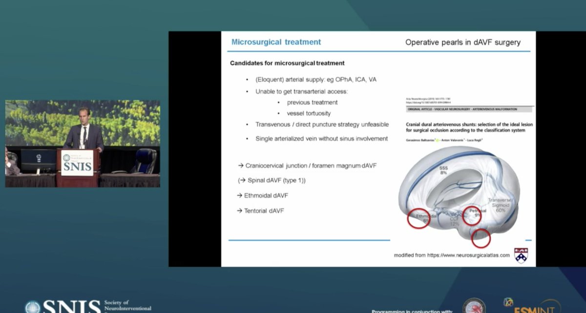 JNIS (@jnis_bmj) on Twitter photo Dr. <a href="/jankarlburkhar1/">Jan-Karl Burkhardt, MD</a> operative pearls on dAVF surgery. Which ones are amenable to open surgery?
#SNIS2021 #NeuroIRTip <a href="/SNISinfo/">SNIS Info</a> <a href="/esmintsociety/">ESMINT Society</a> <a href="/GuenegoAdrien/">The French Brain Doctor</a> <a href="/lila_sheikhi/">Lila Sheikhi, MD</a> <a href="/DanniDiestro/">Dr. DiestroKE</a> <a href="/fcalbuquerque51/">Felipe C. Albuquerque</a> <a href="/aggiemarie93/">Marie Williams Denslow</a> <a href="/rdeleacymd/">Reade De Leacy MD</a> <a href="/SandraNarayanan/">Sandra Narayanan, MD, FAHA, FANA, FSVIN, FAAN</a> <a href="/Fie0815/">Jens Fiehler</a> Dr. <a href="/jankarlburkhar1/">Jan-Karl Burkhardt, MD</a> operative pearls on dAVF surgery. Which ones are amenable to open surgery?
#SNIS2021 #NeuroIRTip <a href="/SNISinfo/">SNIS Info</a> <a href="/esmintsociety/">ESMINT Society</a> <a href="/GuenegoAdrien/">The French Brain Doctor</a> <a href="/lila_sheikhi/">Lila Sheikhi, MD</a> <a href="/DanniDiestro/">Dr. DiestroKE</a> <a href="/fcalbuquerque51/">Felipe C. Albuquerque</a> <a href="/aggiemarie93/">Marie Williams Denslow</a> <a href="/rdeleacymd/">Reade De Leacy MD</a> <a href="/SandraNarayanan/">Sandra Narayanan, MD, FAHA, FANA, FSVIN, FAAN</a> <a href="/Fie0815/">Jens Fiehler</a>