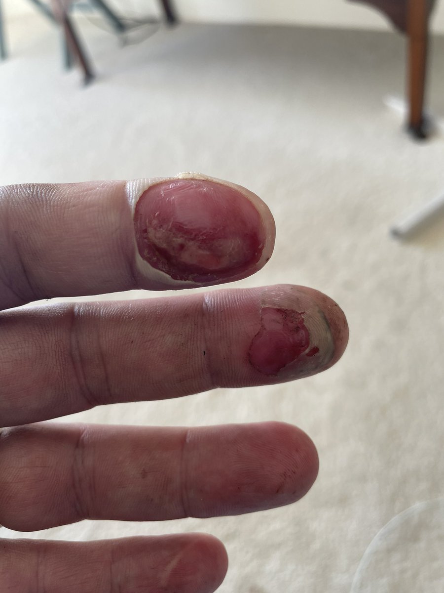 LukeMackayCooks's tweet image. Come to @highgrangedevon #fireschool