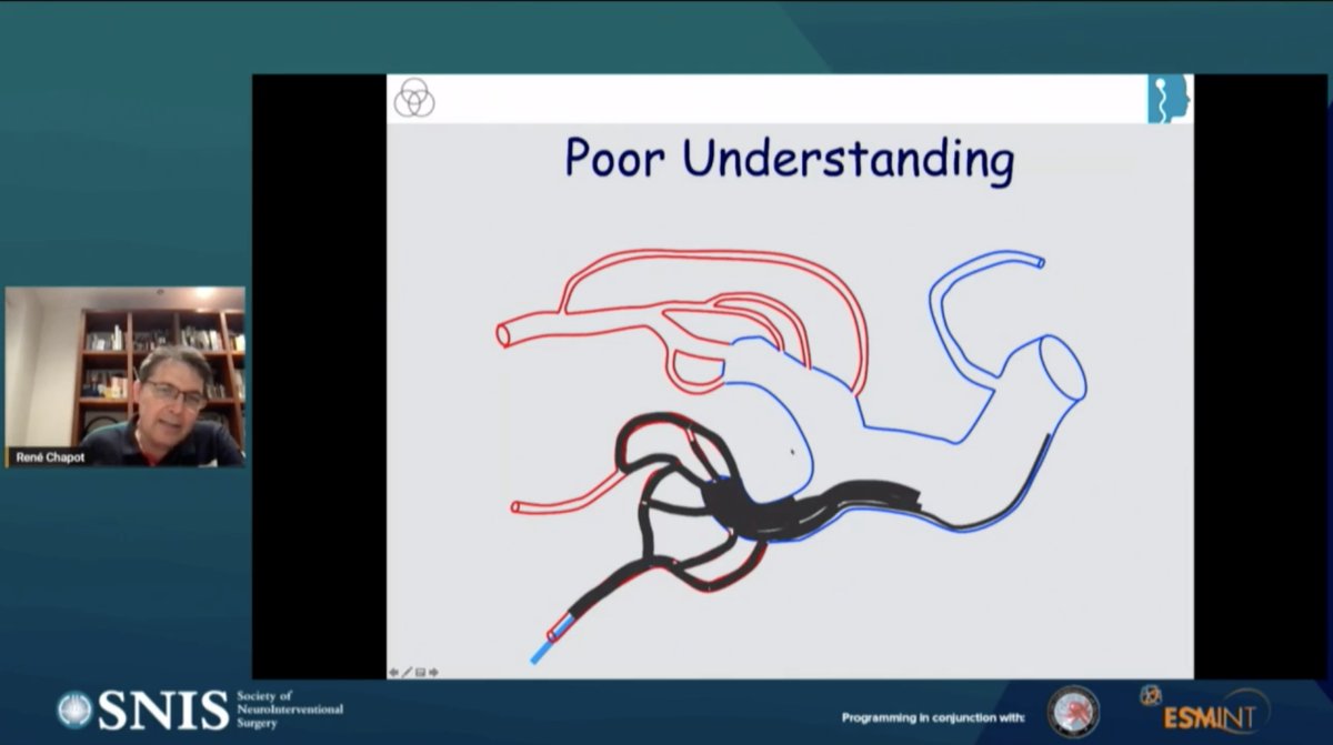 KunalVakhariaMD's tweet photo. Dr. Rene Chapot describing how little we actually understand the #AVM #nidus and how it impacts #endovascular interventions including #transvenous and #transarterial #embolization 
#SNIS2021 @esmintsociety @SNISinfo @JNIS_BMJ #Neurosurgery #medtwitter https://t.co/spxOr6zM5f