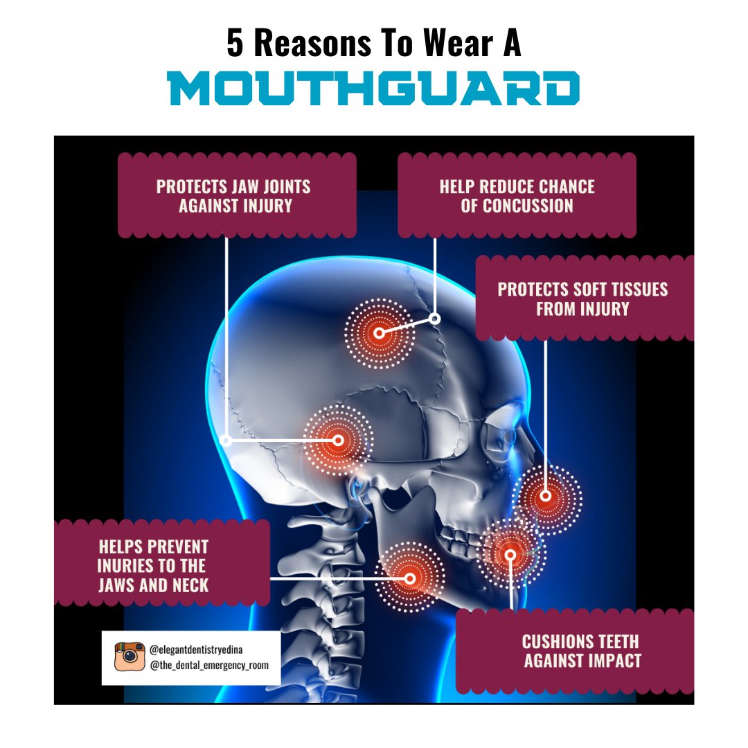 TheDentalERUS's tweet image. When it comes to protecting your mouth, a mouthguard is an essential piece of athletic gear that should be part of your standard equipment from an early age.

#chippedtooth #crackedtooth #DentalEmergencies